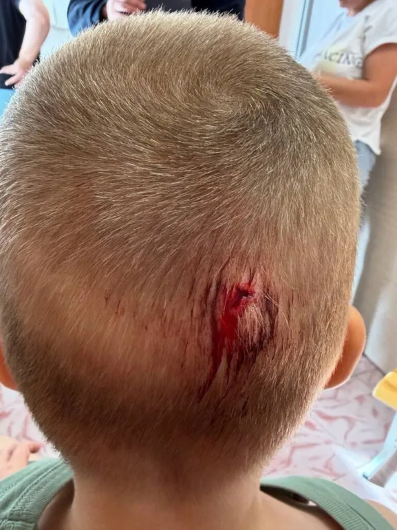 Шкаф упал на детей в томском детсаду: СК проводит проверку